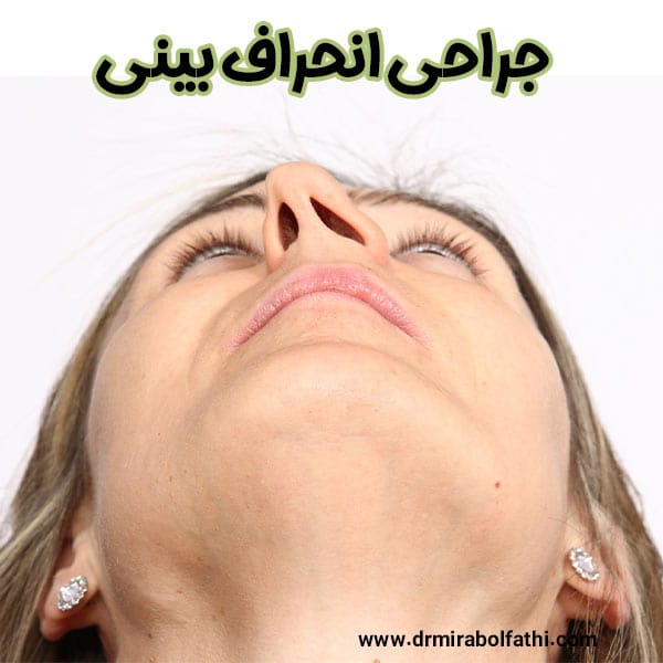 عکس جراحی انحراف بینی