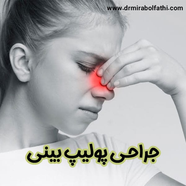 عکس پولیپ بینی- دکتر صبا میرابوالفتحی