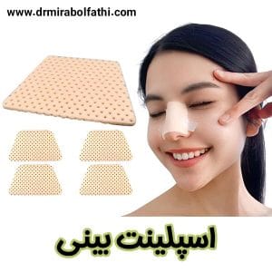 اسپلینت بینی - دکتر صبا میرابوالفتحی