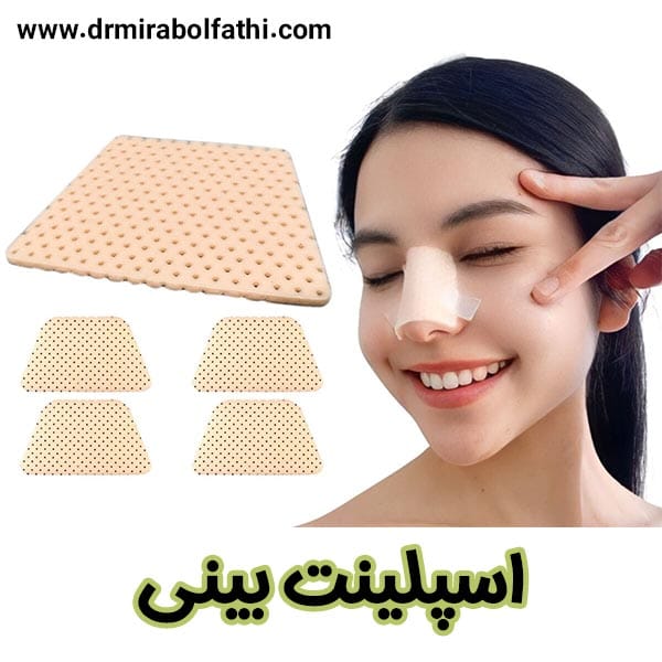اسپلینت بینی - دکتر صبا میرابوالفتحی