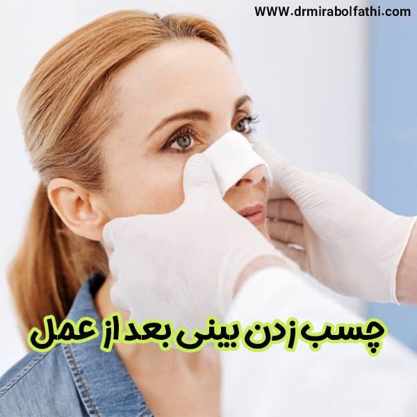 چسب زدن بینی بعد از عمل - دکتر صبا میرابوالفتحی