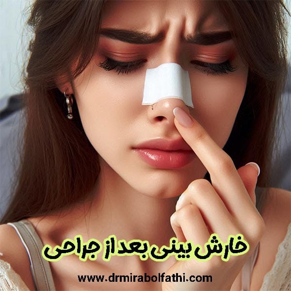 خارش بینی بعد از جراحی - دکتر صبا میرابوالفتحی