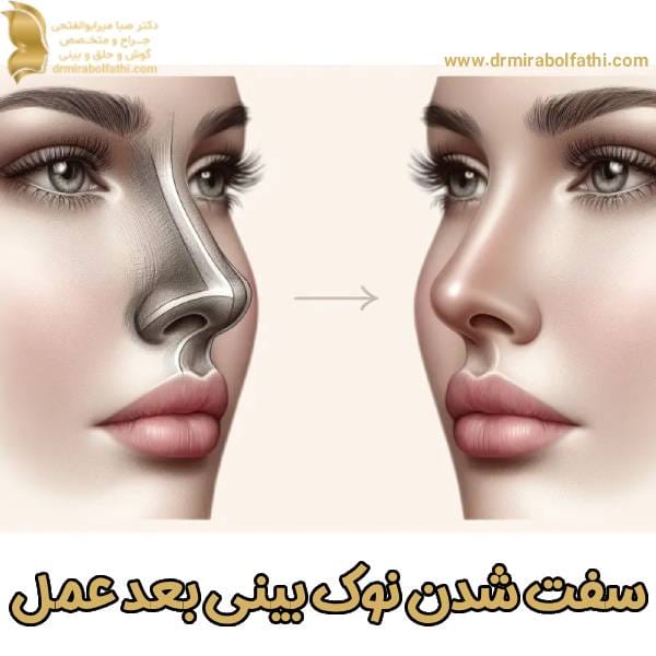 سفت شدن نوک بینی بعد عمل - دکتر صبا میر ابوالفتحی